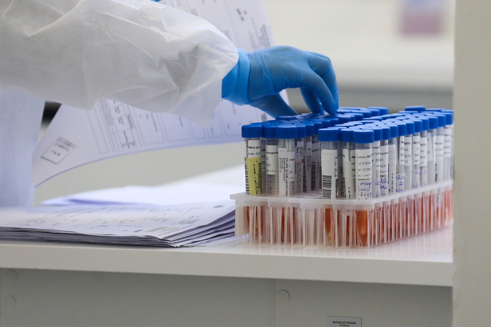 PERNAMBUCO CHEGA A 100 MIL CASOS DE COVID-19