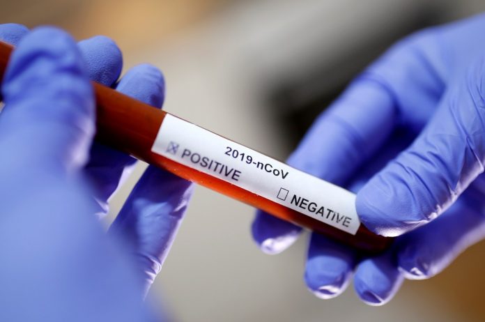 CASOS DE REINFECÇÃO E SEGUNDA ONDA DA COVID-19 PREOCUPAM SAÚDE NA BAHIA