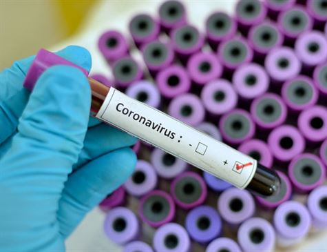 SOBEM PARA 28 OS CASOS CONFIRMADOS DO NOVO CORONAVÍRUS EM PERNAMBUCO